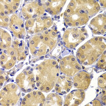 TERE1 / UBIAD1 Antibody - Immunohistochemistry of paraffin-embedded human stomach using UBIAD1 antibody at dilution of 1:100 (40x lens).