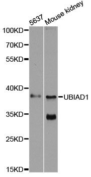 TERE1 / UBIAD1 Antibody - Western blot analysis of extracts of various cell lines, using UBIAD1 antibody at 1:500 dilution. The secondary antibody used was an HRP Goat Anti-Rabbit IgG (H+L) at 1:10000 dilution. Lysates were loaded 25ug per lane and 3% nonfat dry milk in TBST was used for blocking. An ECL Kit was used for detection and the exposure time was 60s.