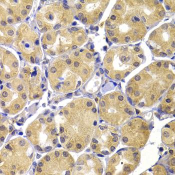 TERE1 / UBIAD1 Antibody - Immunohistochemistry of paraffin-embedded Human stomach using UBIAD1 Polyclonal Antibody at dilution of 1:100 (40x lens).