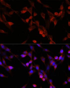 TERE1 / UBIAD1 Antibody - Immunofluorescence analysis of NIH/3T3 cells using UBIAD1 Polyclonal Antibody at dilution of 1:100.Blue: DAPI for nuclear staining.