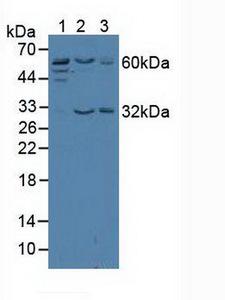 TERF2 / TRF2 Antibody - Western Blot; Sample: Lane1: Human Jurkat Cells; Lane2: Human HeLa Cells; Lane3: Human K562 Cells.
