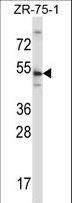 TERF2 / TRF2 Antibody - TERF2 Antibody western blot of ZR-75-1 cell line lysates (35 ug/lane). The TERF2 antibody detected the TERF2 protein (arrow).