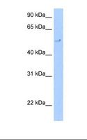 TERF2 / TRF2 Antibody - Transfected 293T cell lysate. Antibody concentration: 5.0 ug/ml. Gel concentration: 12%.  This image was taken for the unconjugated form of this product. Other forms have not been tested.