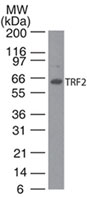 TERF2 / TRF2 Antibody - Western blot of TRF2 in human Jurkat cell lysate using TRF2 antibody at 2 ug/ml.