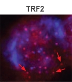 TERF2 / TRF2 Antibody - Immunofluorescent staining of TRF2-bound telomeres in human HeLa cells (Courtesy of Fotiadou, et al, 2004).