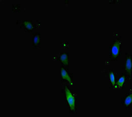 TERF2 / TRF2 Antibody - Immunofluorescent analysis of Hela cells diluted at 1:100 and Alexa Fluor 488-congugated AffiniPure Goat Anti-Rabbit IgG(H+L)