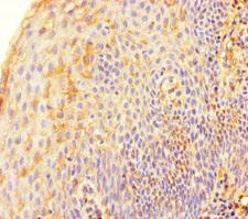 TERF2 / TRF2 Antibody - Immunohistochemistry of paraffin-embedded human tonsil tissue at dilution of 1:100