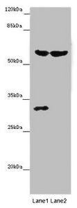 TERF2 / TRF2 Antibody - Western blot All Lanes: TERF2 antibody at 14 ug/ml Lane 1: Mouse thymus tissue Lane 2: MCF7 whole cell lysate Secondary Goat polyclonal to rabbit IgG at 1/10000 dilution Predicted band size: 60,33 kDa Observed band size: 60,31 kDa