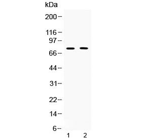 TERF2 / TRF2 Antibody - Western blot testing of 1) rat thymus and 2) human COLO320 lysate with TRF2 antibody at 0.5ug/ml. Predicted molecular weight ~75 kDa.