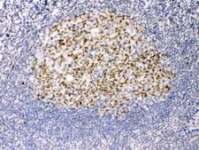 TERF2 / TRF2 Antibody - IHC testing of FFPE human tonsil tissue with TRF2 antibody at 1ug/ml. Required HIER: steam section in pH6 citrate buffer for 20 min and allow to cool prior to testing.