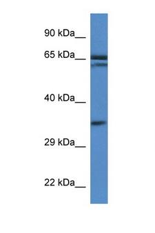 TERF2IP / RAP1 Antibody - TERF2IP antibody Western blot of Mouse Pancreas lysate. Antibody concentration 1 ug/ml. This image was taken for the unconjugated form of this product. Other forms have not been tested.