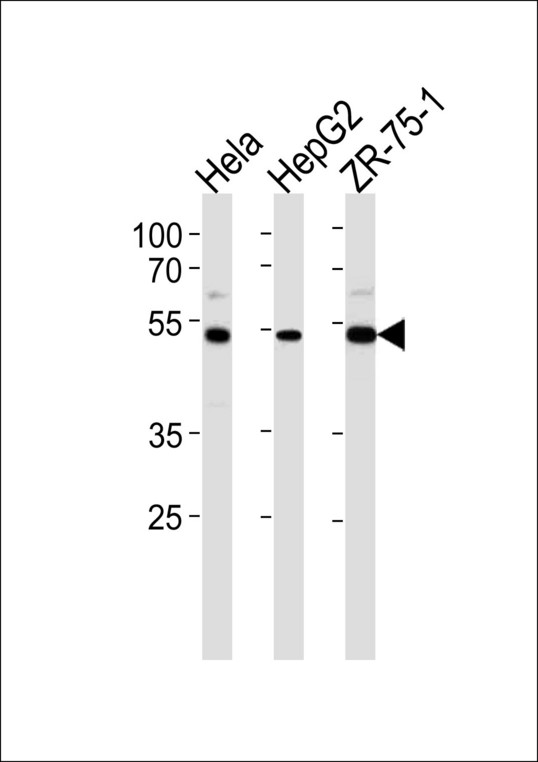TERF2IP / RAP1 Antibody - TERF2IP Antibody western blot of HeLa,HepG2,ZR-75-1 cell line lysates (35 ug/lane). The TE2IP antibody detected the TE2IP protein (arrow).