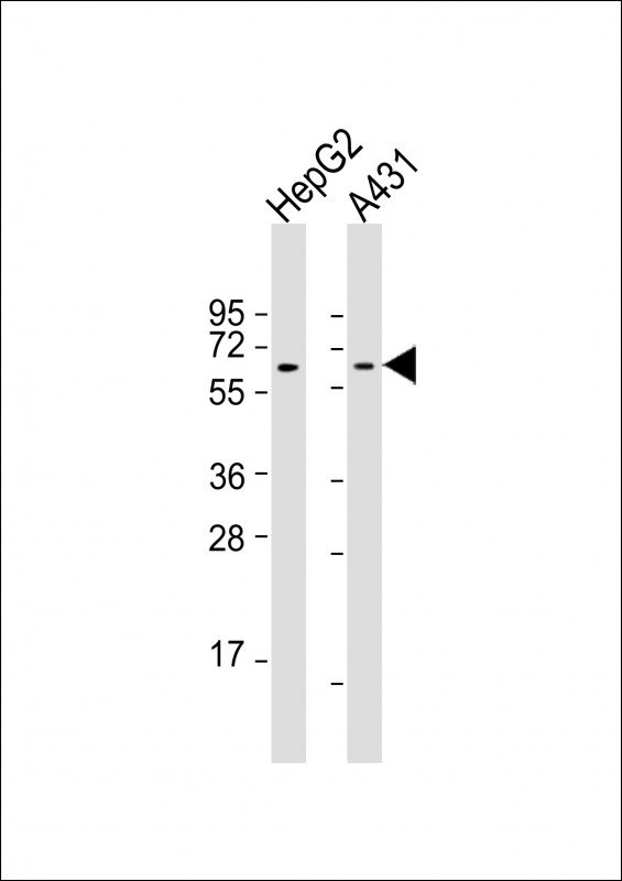 TERF2IP / RAP1 Antibody - All lanes: Anti-TERF2IP Antibody at 1:2000 dilution Lane 1: HepG2 whole cell lysate Lane 2: A431 whole cell lysate Lysates/proteins at 20 µg per lane. Secondary Goat Anti-mouse IgG, (H+L), Peroxidase conjugated at 1/10000 dilution. Predicted band size: 44 kDa Blocking/Dilution buffer: 5% NFDM/TBST.