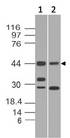 TERF2IP / RAP1 Antibody - Fig-1: Western blot analysis of Rap1. Anti-Rap1 antibody was used at 2 µg/ml on Daudi and Ramos lysates.