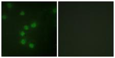 TERT / Telomerase Antibody - Immunofluorescence analysis of HUVEC cells, using Telomerase Antibody. The picture on the right is blocked with the synthesized peptide.