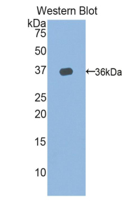 TERT / Telomerase Antibody - Western blot of recombinant TERT / Telomerase.  This image was taken for the unconjugated form of this product. Other forms have not been tested.