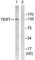 TERT / Telomerase Antibody - Western blot analysis of lysates from Jurkat cells, using Telomerase Antibody. The lane on the right is blocked with the synthesized peptide.