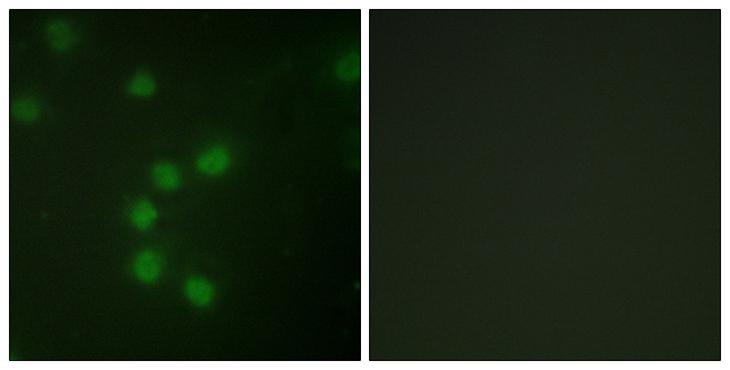 TERT / Telomerase Antibody - Peptide - + Immunofluorescence analysis of HUVEC cells, using Telomerase antibody.