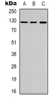 TERT / Telomerase Antibody - Western blot analysis of Telomerase expression in HeLa (A); HEK293T (B); L929 (C) whole cell lysates.