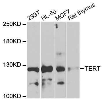 TERT / Telomerase Antibody - Western blot analysis of extracts of various cell lines.