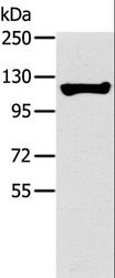 TERT / Telomerase Antibody - Western blot analysis of Human fetal liver tissue, using TERT Polyclonal Antibody at dilution of 1:200.