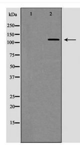 TERT / Telomerase Antibody - Western blot of TERT expression in Jurkat cell extracts