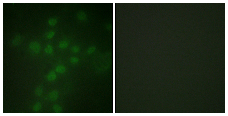 TERT / Telomerase Antibody - Immunofluorescence analysis of HUVEC cells, using Telomerase (Phospho-Ser227) Antibody. The picture on the right is blocked with the phospho peptide.