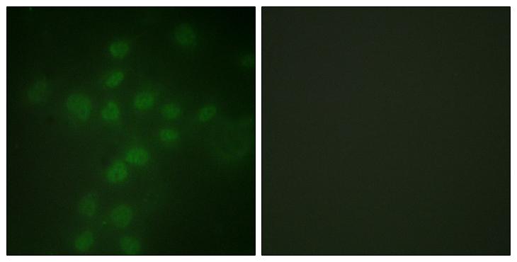 TERT / Telomerase Antibody - P-peptide - + Immunofluorescence analysis of HuvEC cells, using Telomerase (Phospho-Ser227) antibody. Telomerase (Phospho-Ser227) antibody reacts with epitope-specific phosphopeptide and corresponding non-phosphopeptide.