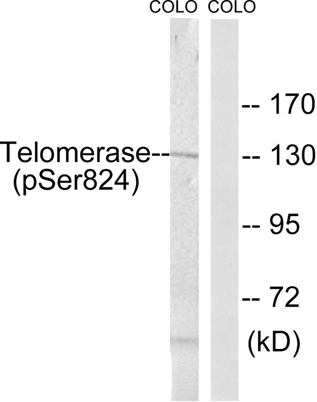 TERT / Telomerase Antibody - Western blot analysis of lysates from COLO205 cells, using Telomerase (Phospho-Ser824) Antibody. The lane on the right is blocked with the phospho peptide.