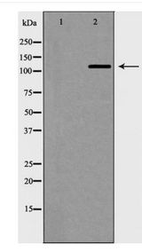 TERT / Telomerase Antibody - Western blot of Telomerase (Phospho-Ser824) expression in Jurkat cell extracts
