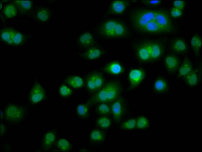 TES / Testin Antibody - Immunofluorescence staining of Hela cells diluted at 1:266, counter-stained with DAPI. The cells were fixed in 4% formaldehyde, permeabilized using 0.2% Triton X-100 and blocked in 10% normal Goat Serum. The cells were then incubated with the antibody overnight at 4°C.The Secondary antibody was Alexa Fluor 488-congugated AffiniPure Goat Anti-Rabbit IgG (H+L).