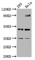 TES / Testin Antibody - Western Blot Positive WB detected in: 293 whole cell lysate, Hela whole cell lysate All Lanes: TES antibody at 2.92µg/ml Secondary Goat polyclonal to rabbit IgG at 1/50000 dilution Predicted band size: 48 KDa Observed band size: 48 KDa