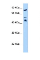 TES / Testin Antibody - TES / Testin antibody Western blot of HeLa Cell lysate. Antibody concentration 1 ug/ml.  This image was taken for the unconjugated form of this product. Other forms have not been tested.