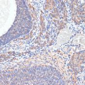 TES / Testin Antibody - Immunohistochemistry of paraffin-embedded Rat ovary using TES Polyclonal Antibody at dilution of 1:100 (40x lens).