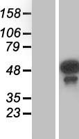 TES / Testin Protein - Western validation with an anti-DDK antibody * L: Control HEK293 lysate R: Over-expression lysate