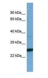 TESC Antibody - TESC antibody Western Blot of Jurkat. Antibody dilution: 1 ug/ml.  This image was taken for the unconjugated form of this product. Other forms have not been tested.