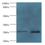 TESC Antibody - Western blot. All lanes: Calcineurin B homologous protein 3 antibody at 2 ug/ml. Lane 1: HeLa whole cell lysate Lane 2: mouse brain tissue. Secondary antibody: goat polyclonal to rabbit at 1:10000 dilution. Predicted band size: 25 kDa. Observed band size: 25 kDa.  This image was taken for the unconjugated form of this product. Other forms have not been tested.