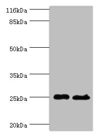 TESC Antibody - Western blot All lanes: Calcineurin B homologous protein 3 antibody at 2µg/ml Lane 1: Hela whole cell lysate Lane 2: Mouse brain tissue Secondary Goat polyclonal to rabbit at 1/10000 dilution Predicted band size: 25, 19, 22 kDa Observed band size: 25 kDa