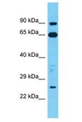 TESC Antibody - TESC antibody Western Blot of HT1080. Antibody dilution: 1 ug/ml.  This image was taken for the unconjugated form of this product. Other forms have not been tested.