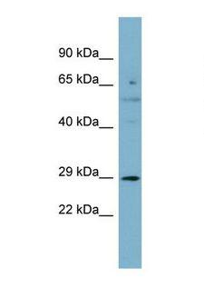 TESC Antibody - Western blot of Human Fetal Spleen. TESC antibody dilution 1.0 ug/ml.  This image was taken for the unconjugated form of this product. Other forms have not been tested.