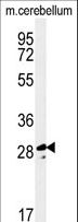 TESC Antibody - Western blot of TESC Antibody in mouse cerebellum tissue lysates (35 ug/lane). TESC (arrow) was detected using the purified antibody.