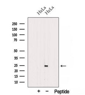 TESC Antibody - Western blot analysis of extracts of HeLa cells using TESC antibody. The lane on the left was treated with blocking peptide.