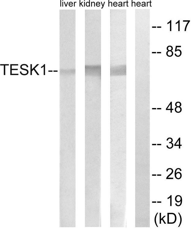 TESK1 Antibody - Western blot analysis of lysates from rat heart, rat kidney, and rat liver cells, using TESK1 Antibody. The lane on the right is blocked with the synthesized peptide.