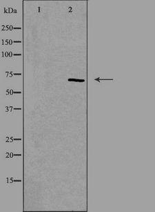 TESK1 Antibody - Western blot analysis of extracts of rat heart cells using TESK1 antibody.