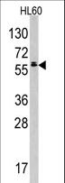 TESK2 Antibody - Western blot of anti-TESK2 Antibody in HL60 cell line lysates (35 ug/lane). TESK2 (arrow) was detected using the purified antibody.