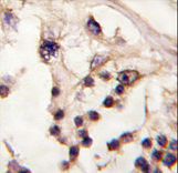 TESK2 Antibody - Formalin-fixed and paraffin-embedded human testis tissue reacted with TESK2 antibody , which was peroxidase-conjugated to the secondary antibody, followed by DAB staining. This data demonstrates the use of this antibody for immunohistochemistry; clinical relevance has not been evaluated.