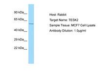 TESK2 Antibody -  This image was taken for the unconjugated form of this product. Other forms have not been tested.