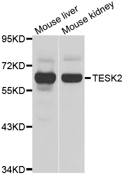 TESK2 Antibody - Western blot analysis of extracts of various cell lines.