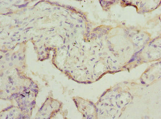 TESK2 Antibody - Immunohistochemistry of paraffin-embedded human placenta tissue at dilution 1:100
