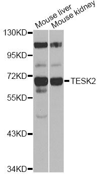 TESK2 Antibody - Western blot analysis of extracts of various cell lines, using TESK2 antibody at 1:1000 dilution. The secondary antibody used was an HRP Goat Anti-Rabbit IgG (H+L) at 1:10000 dilution. Lysates were loaded 25ug per lane and 3% nonfat dry milk in TBST was used for blocking. An ECL Kit was used for detection and the exposure time was 1s.